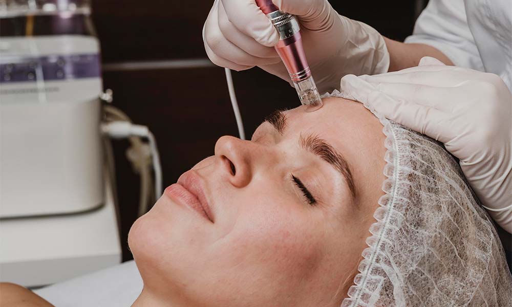 skinpen microneedling aftercare
