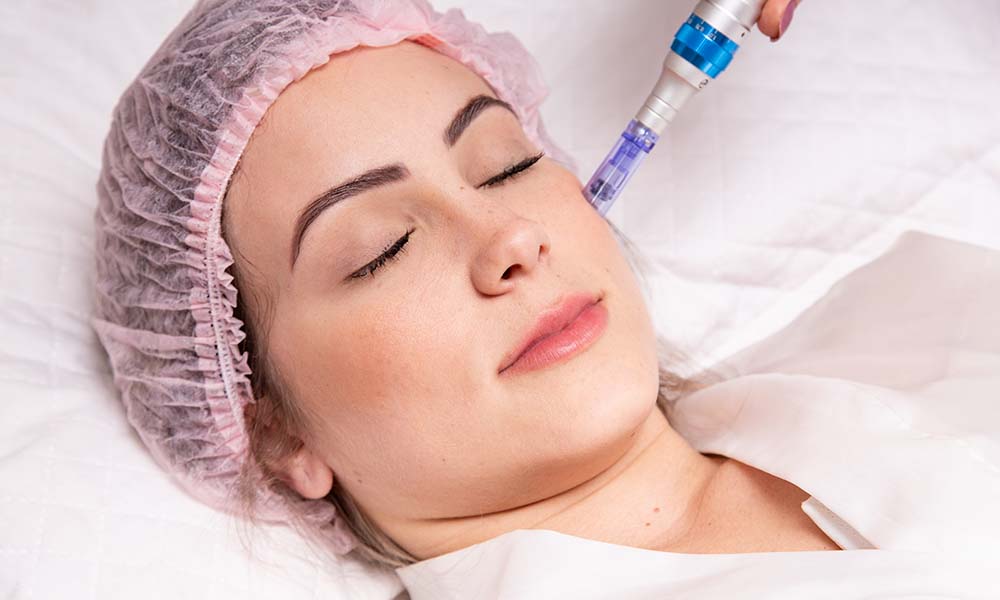 skinpen vs microneedling