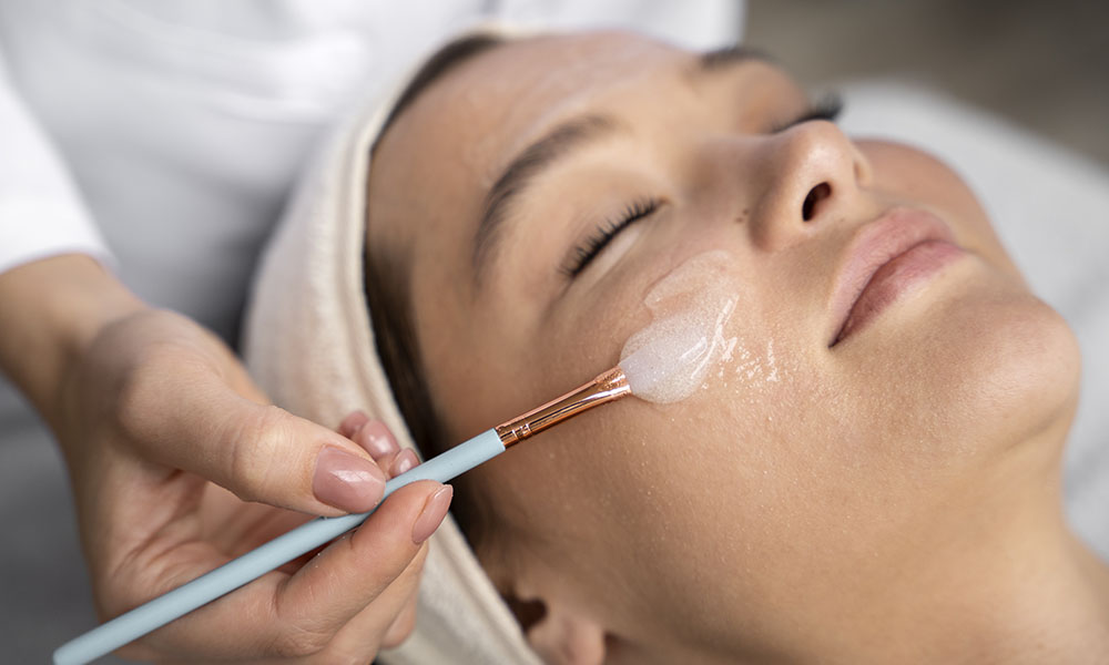 chemical peel for acne scars
