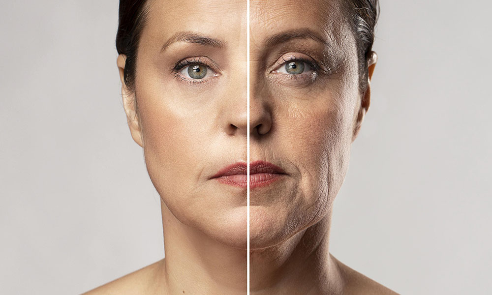 anti wrinkle injections before and after